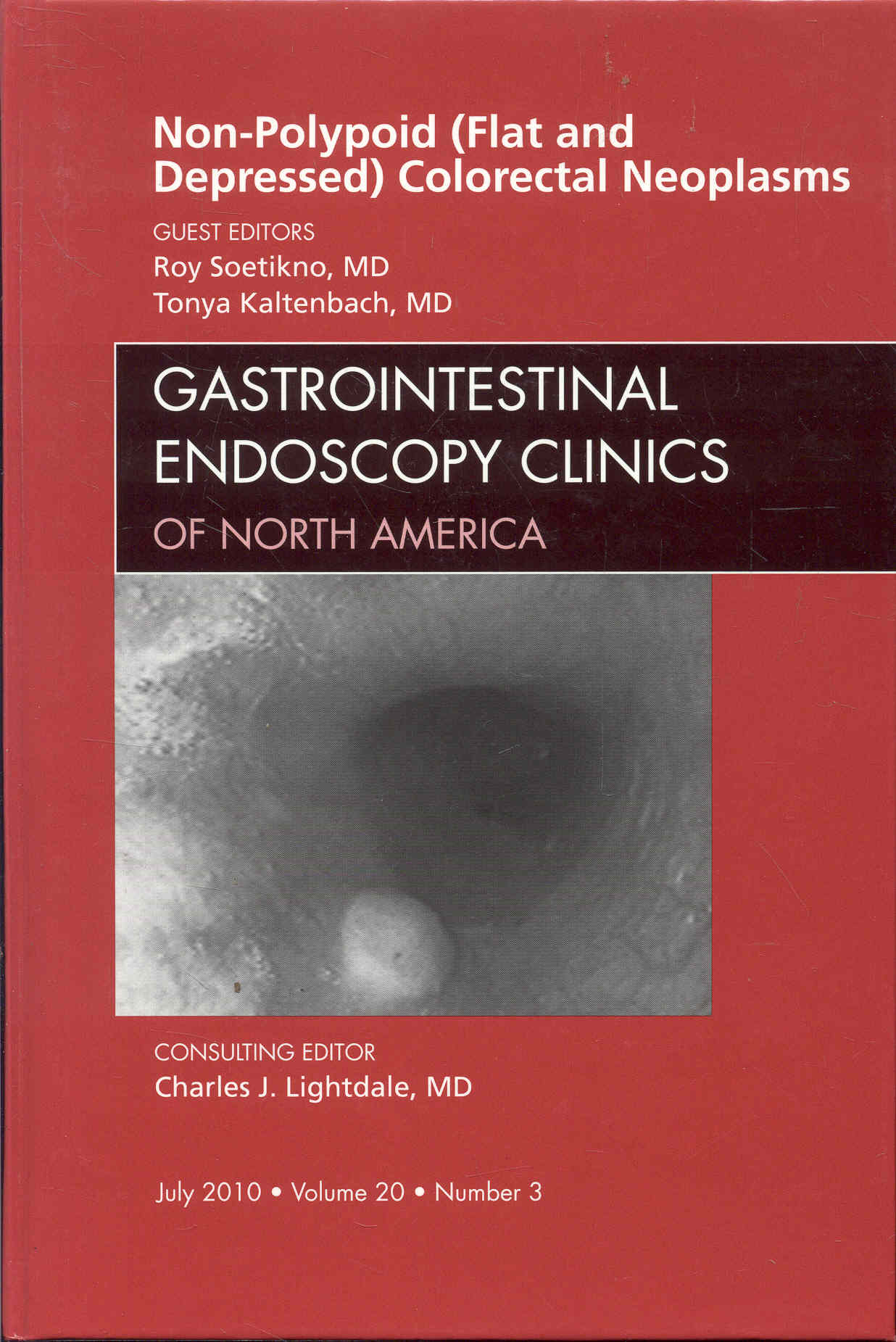 Image for Non-Polypoid (Flat and Depressed) Colorectal Neoplasms (Volume 20, Number 3, July 2010) Non-Polypoid (Flat and Depressed) Colorectal Neoplasms (Volume 20, Number 3, July 2010)