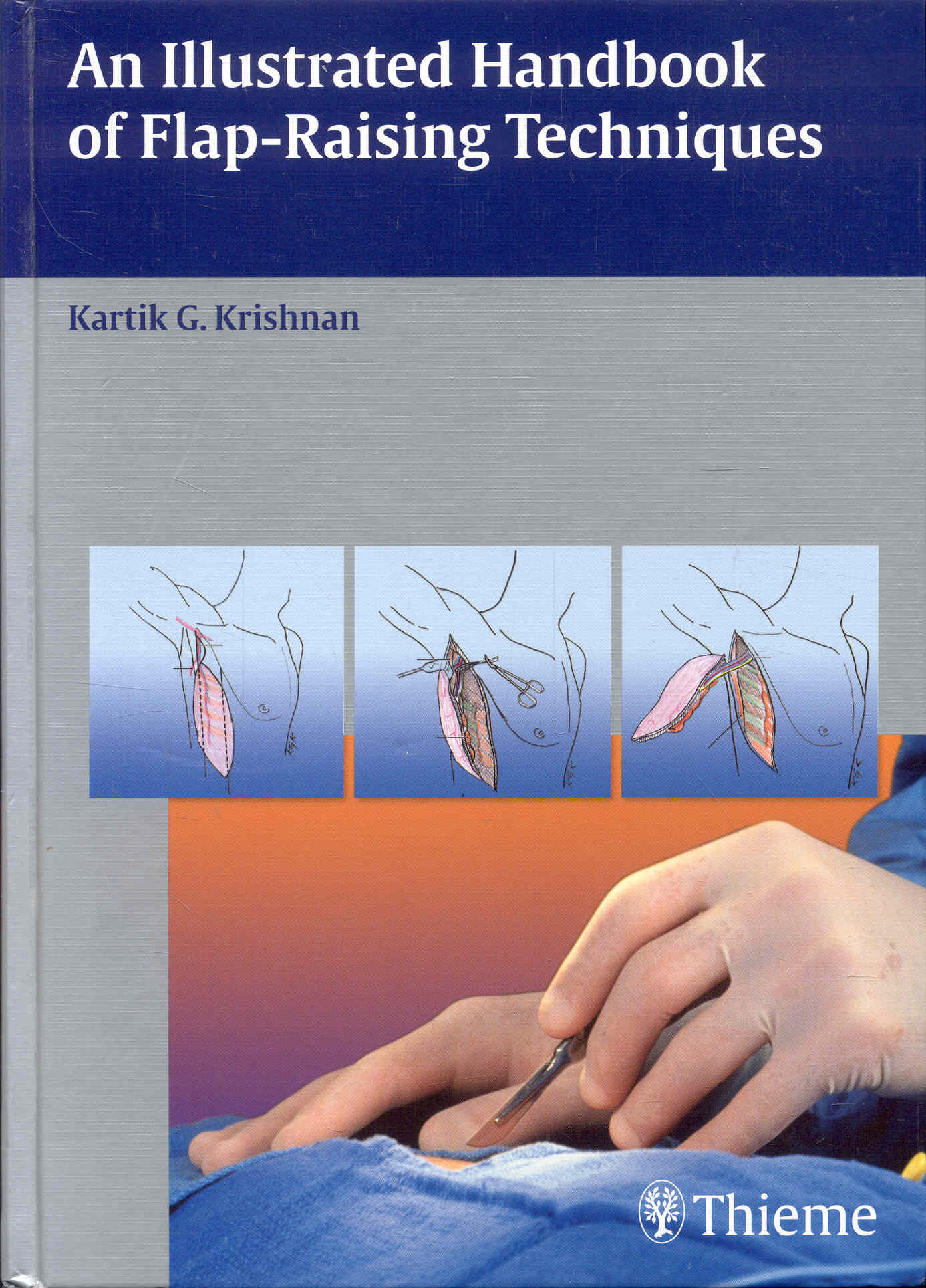 Image for An Illustrated Handbook of Flap-Raising Techniques An Illustrated Handbook of Flap-Raising Techniques